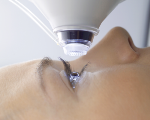 photo d'un oeil opéré de chirurgie laser de la vision par le docteur bordereau à Nantes